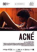 Acné (2007)